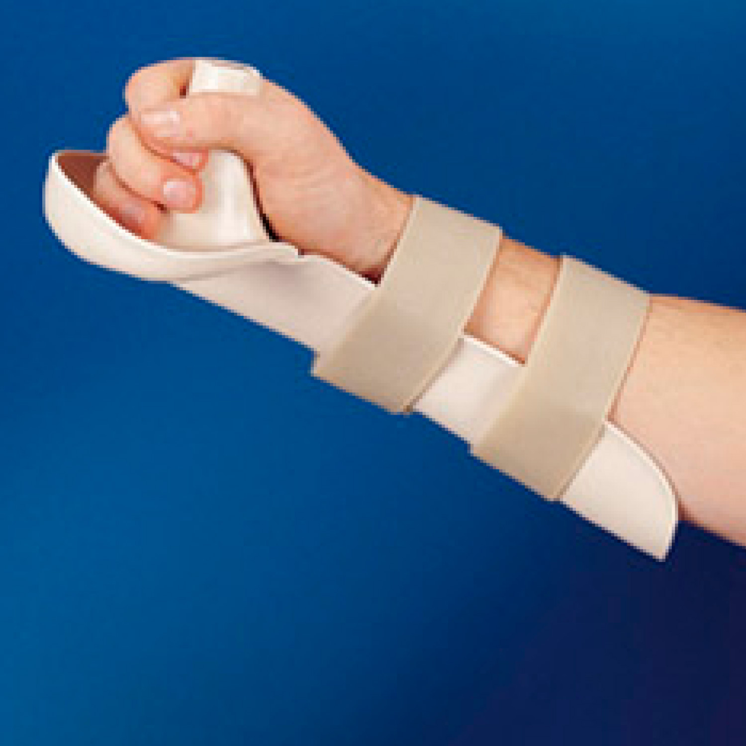 Preformed Spasticity Splint